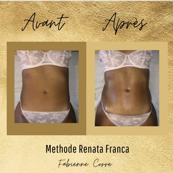 Fabienne Corre - drainage lymphatique Rennes