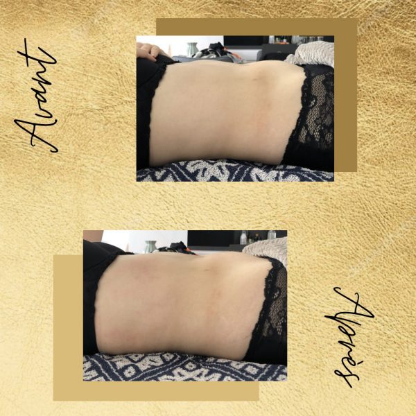 Fabienne Corre - drainage lymphatique Rennes