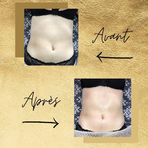 Fabienne Corre - drainage lymphatique Rennes