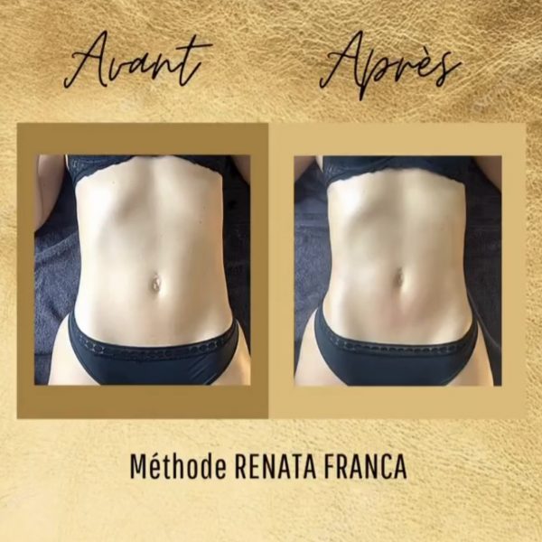 Fabienne Corre - drainage lymphatique Rennes