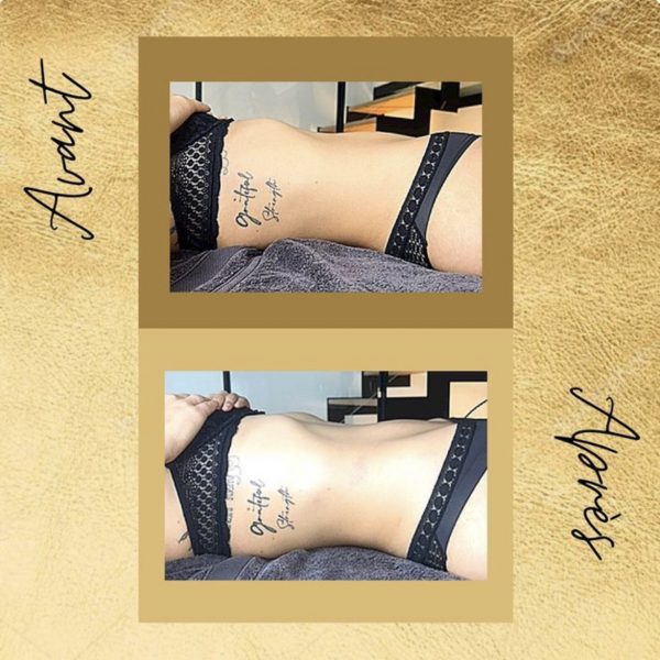 Fabienne Corre - drainage lymphatique Rennes