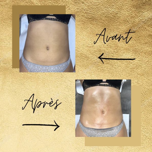 Fabienne Corre - drainage lymphatique Rennes