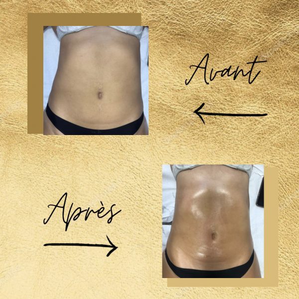 Fabienne Corre - drainage lymphatique Rennes